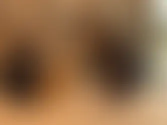 A dog with red eye is examined on the floor by a veterinarian in a vet hospital